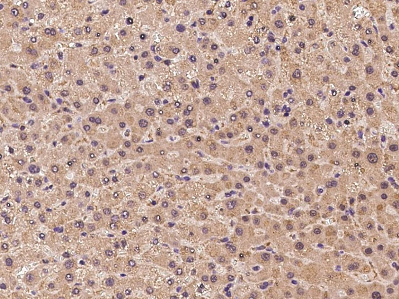 USP32 Antibody - BSA Free