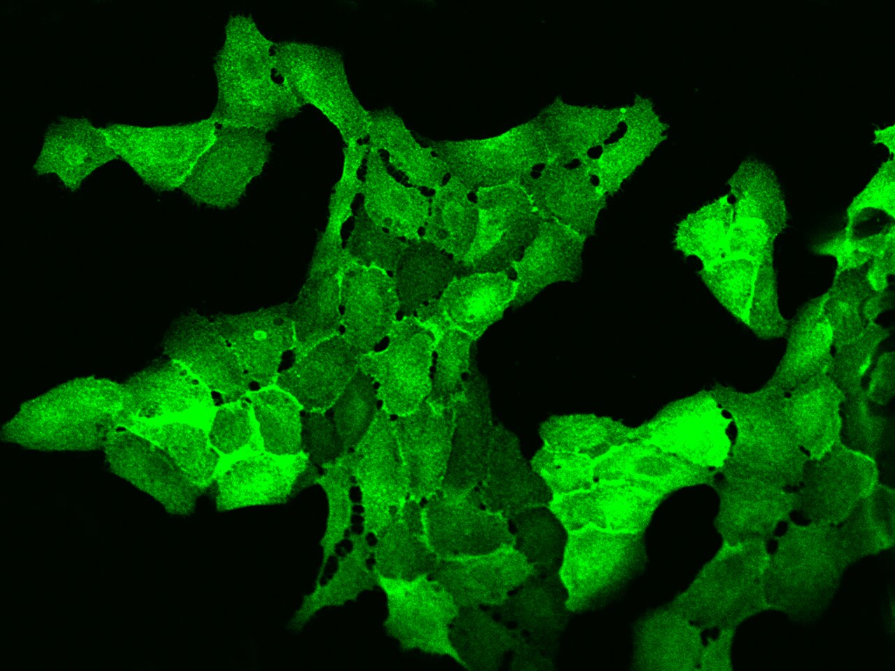 AHNAK2 Antibody - BSA Free