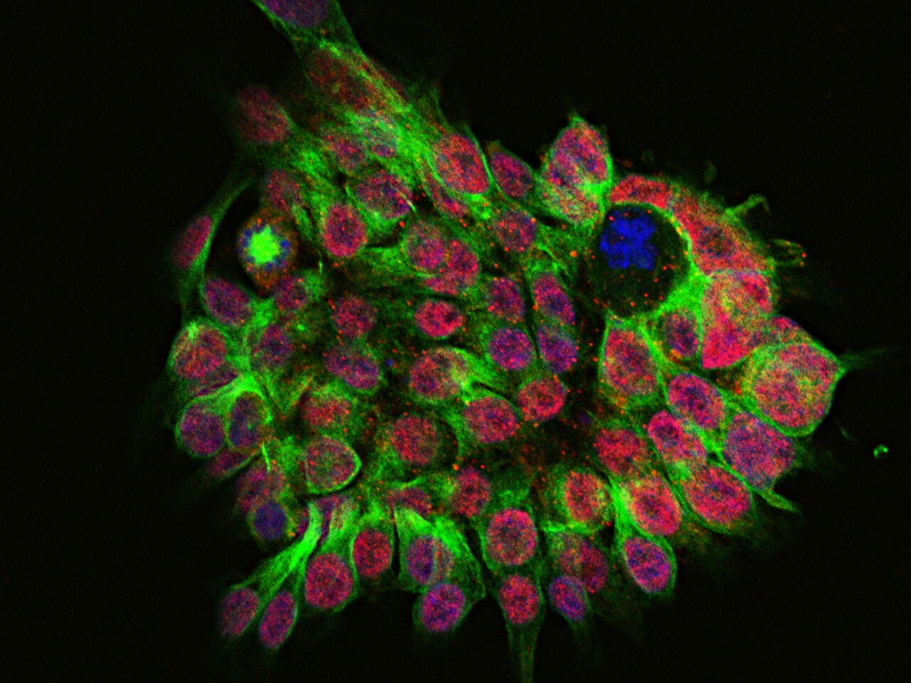 SALL4 Antibody - Azide and BSA Free