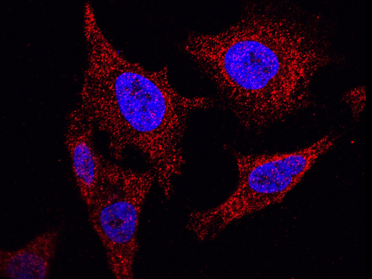 NANOS1 Antibody - Azide and BSA Free