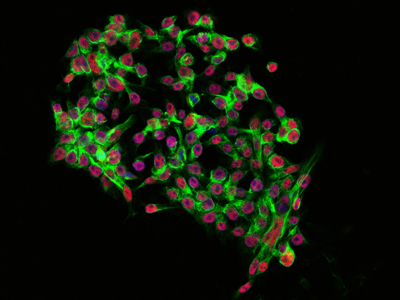 NAC1 Antibody - Azide and BSA Free