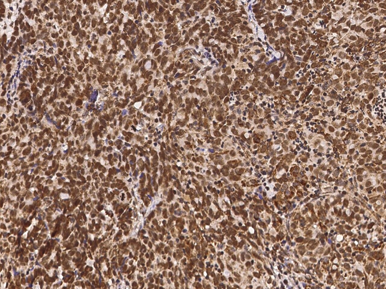 NAC1 Antibody - Azide and BSA Free