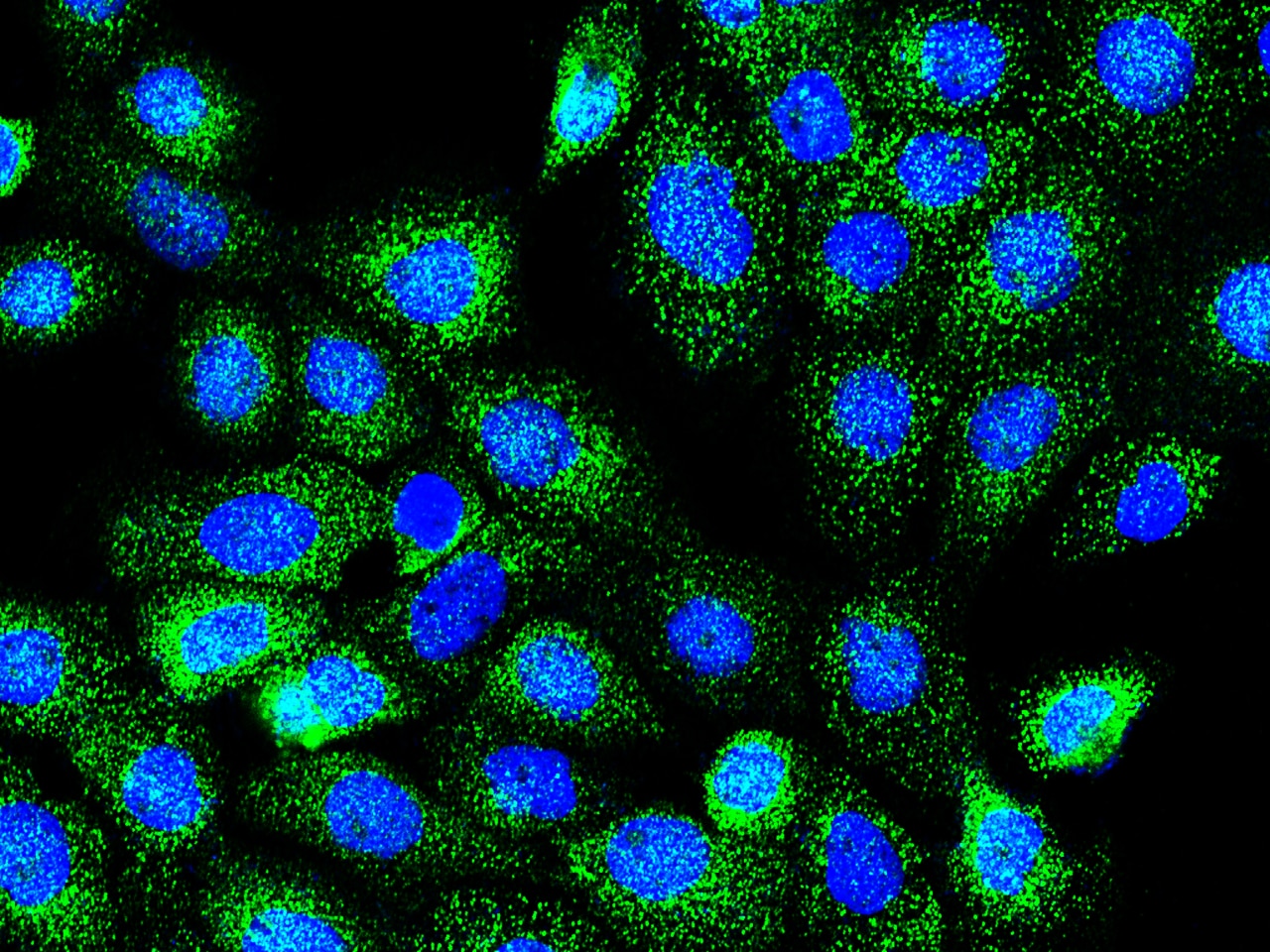Rab7a Antibody - Azide and BSA Free