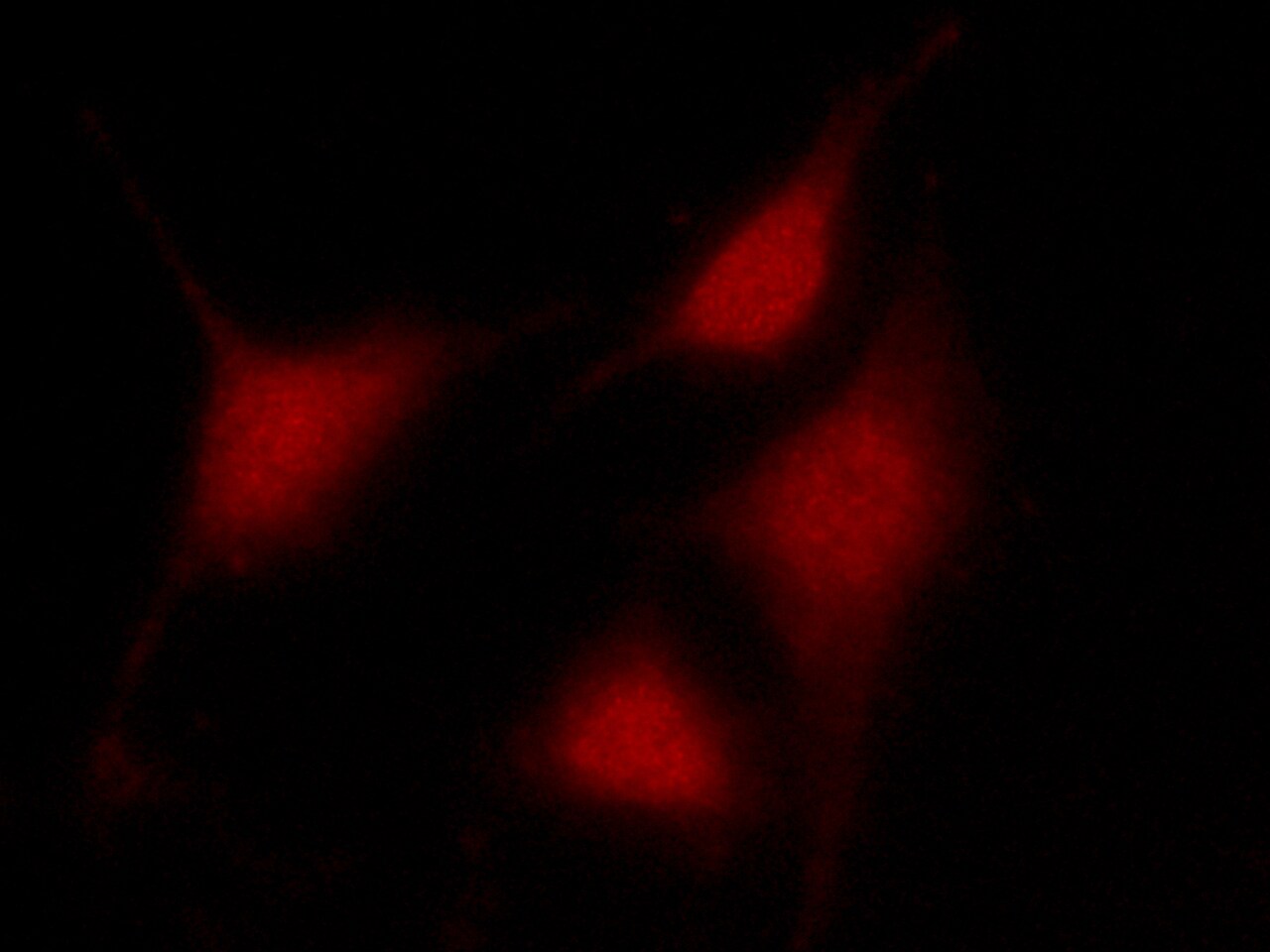 Carm1 Antibody - Azide and BSA Free