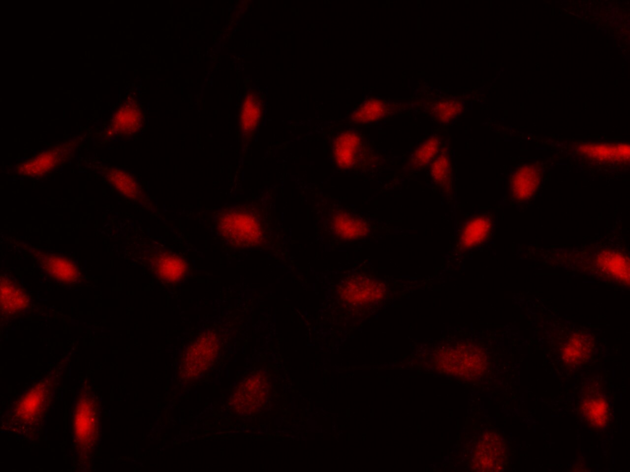 BCOR Antibody - Azide and BSA Free