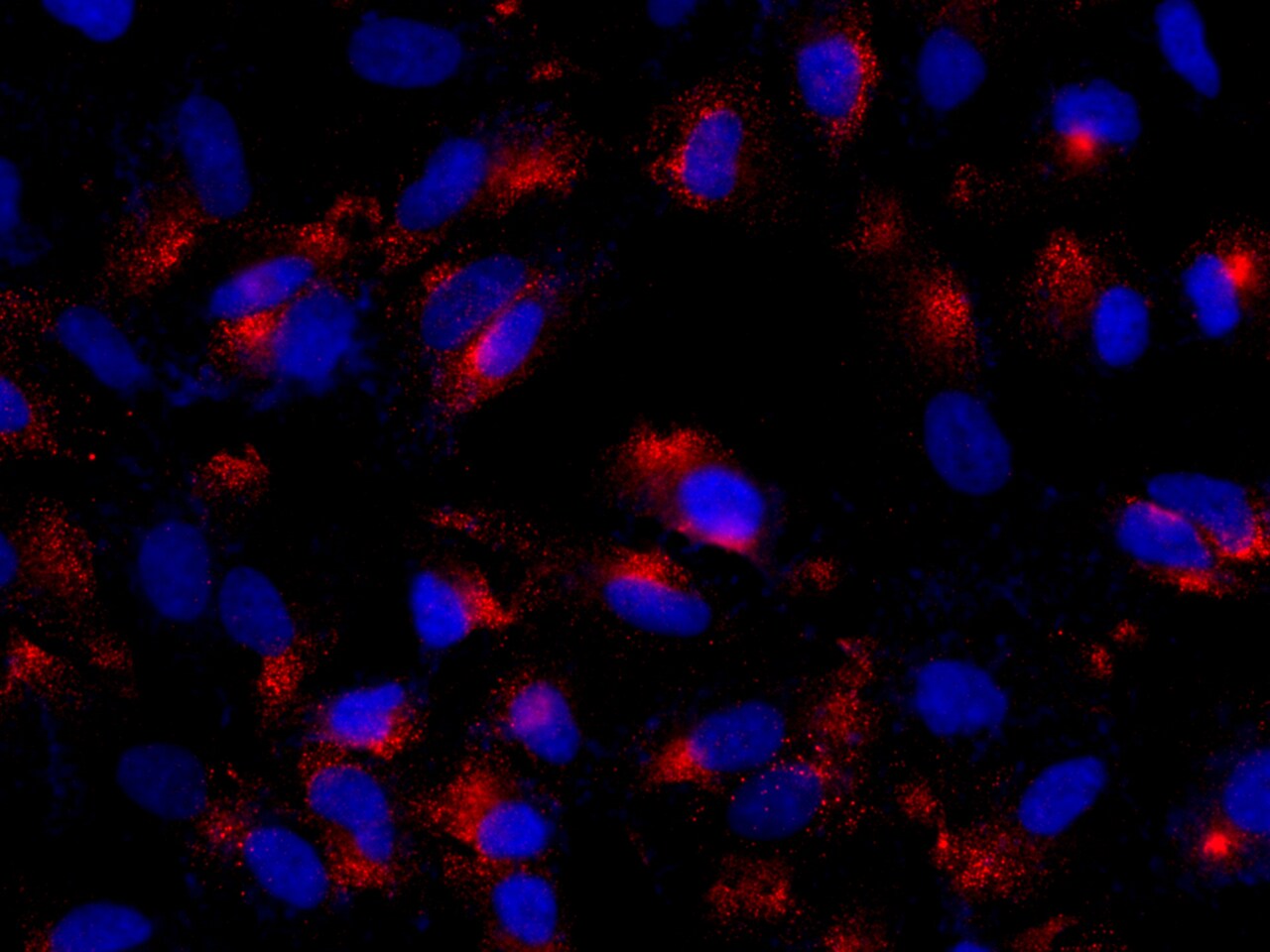 Adenosine Deaminase/ADA Antibody - Azide and BSA Free