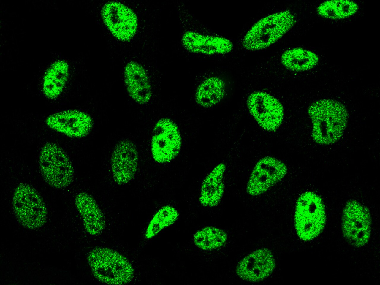 SMARCC1 Antibody - Azide and BSA Free