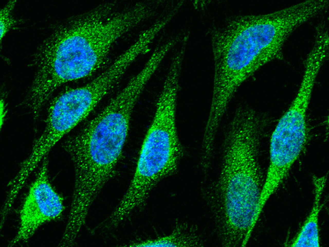 Ets-1 Antibody - Azide and BSA Free