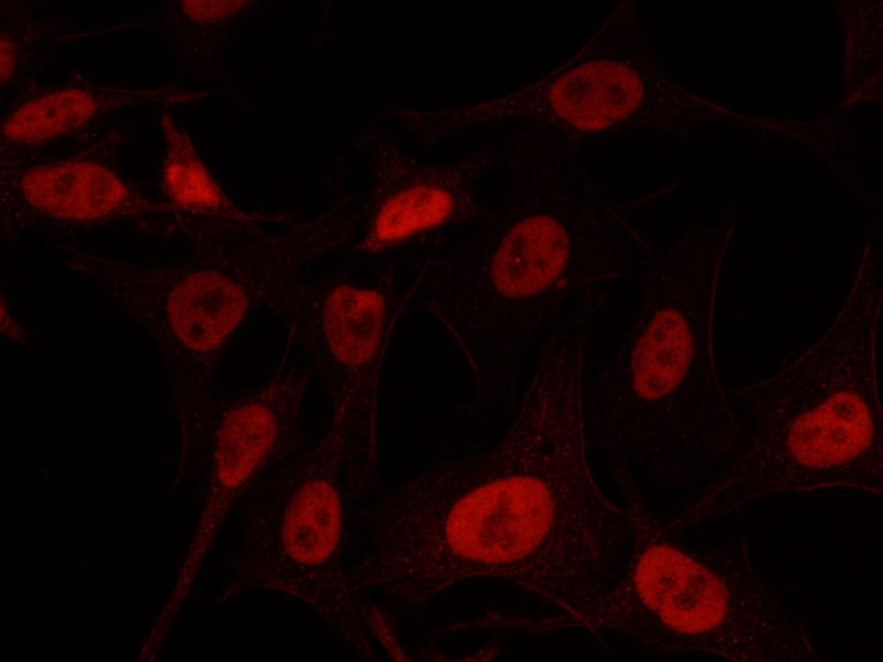 KAT1 Antibody - Azide and BSA Free