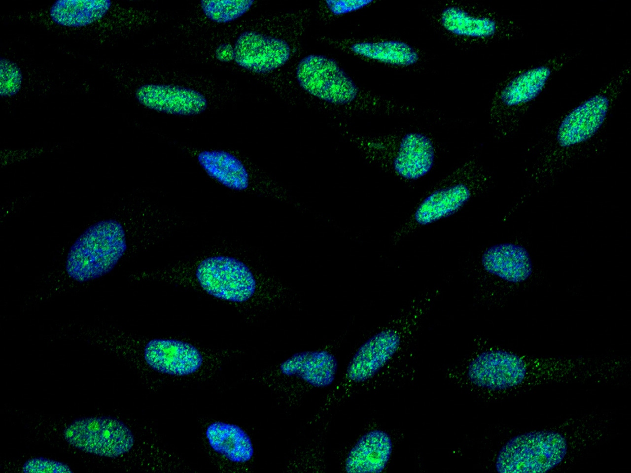 TLK1 Antibody - Azide and BSA Free