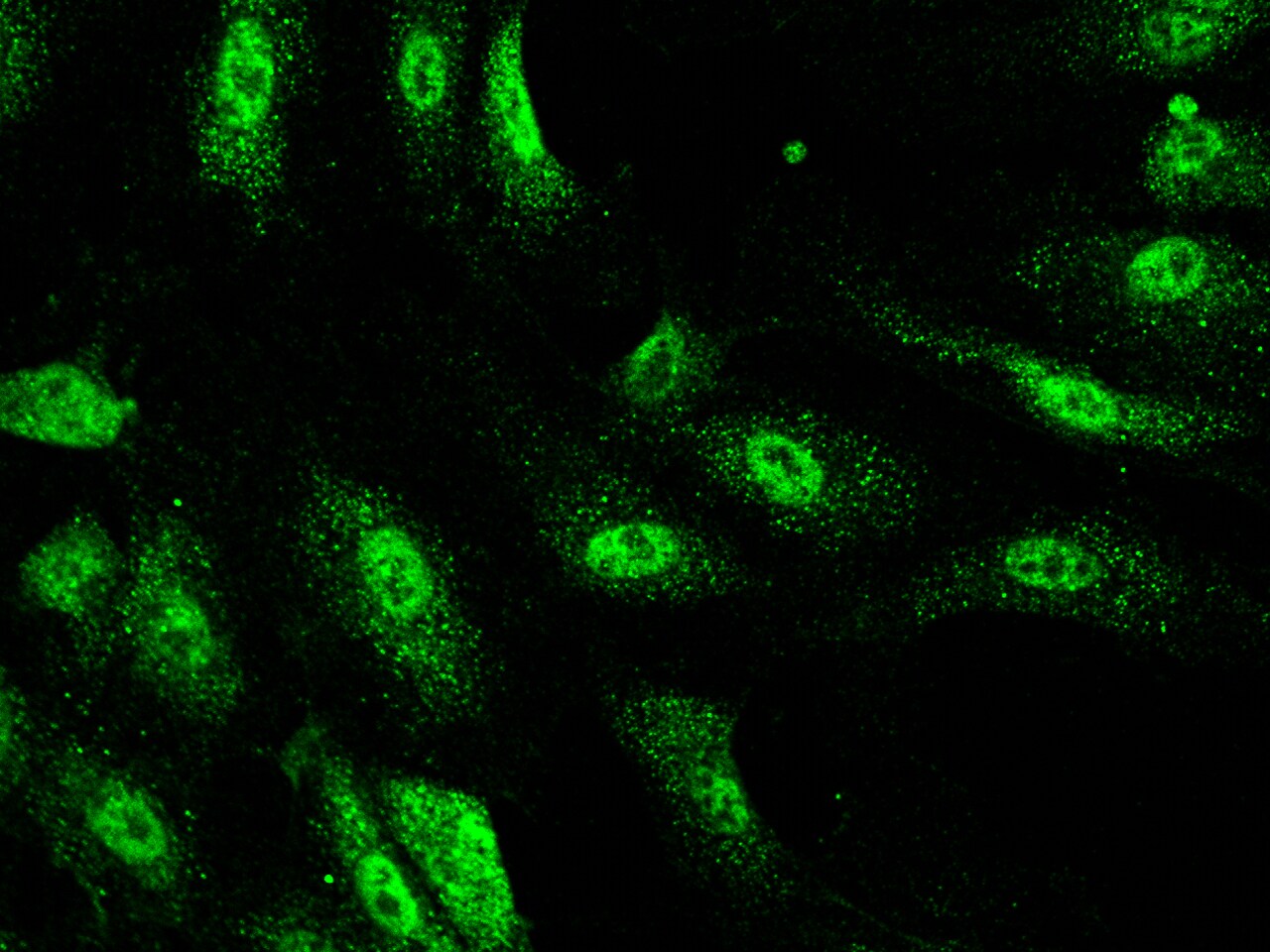 TRIM37 Antibody - Azide and BSA Free