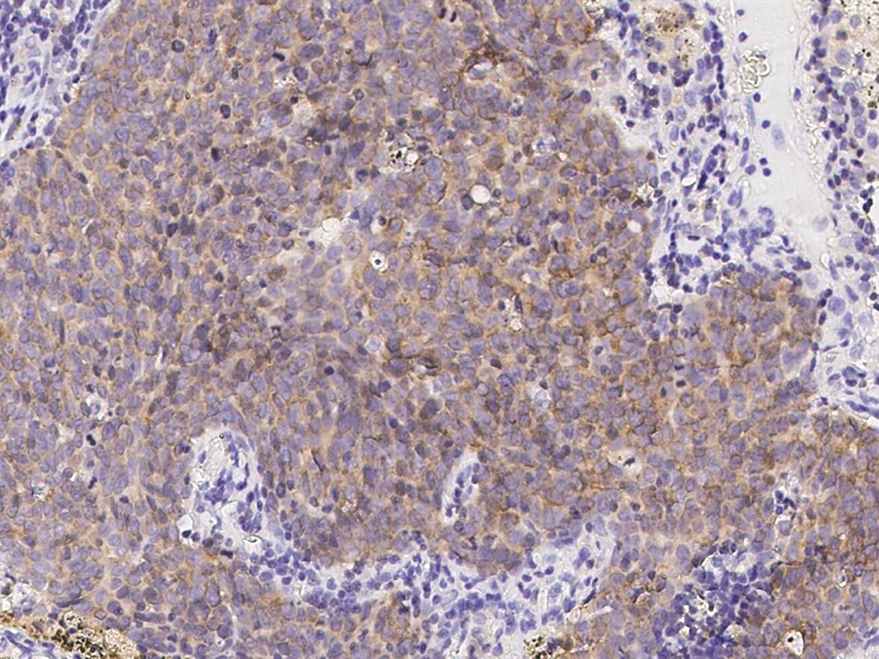 TTK Antibody - Azide and BSA Free