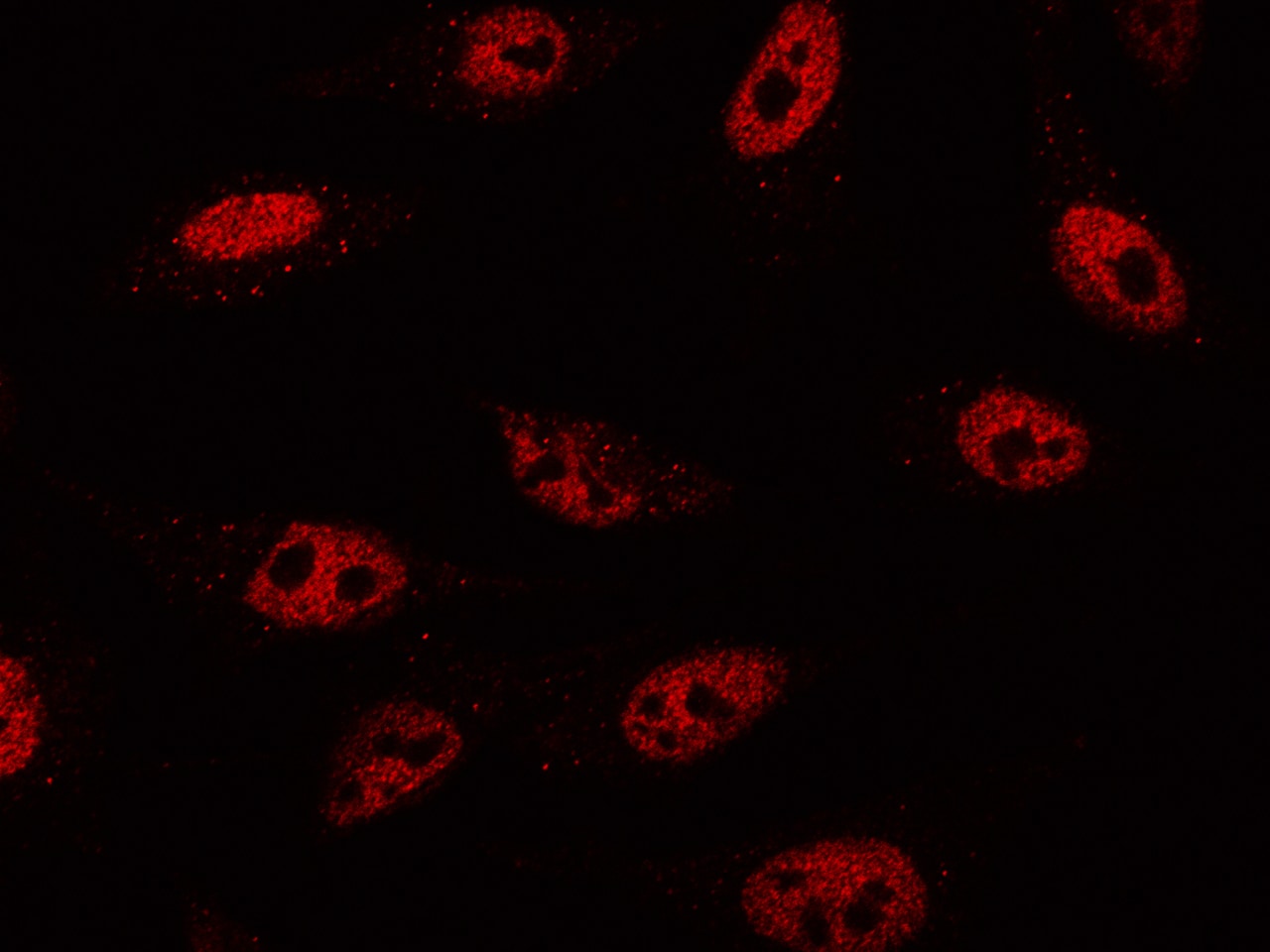 VDR/NR1I1/Vitamin D Receptor Antibody - Azide and BSA Free