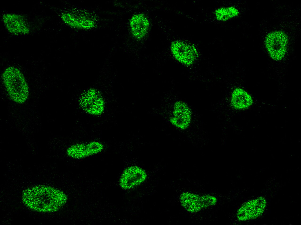 NCOR2 Antibody - Azide and BSA Free