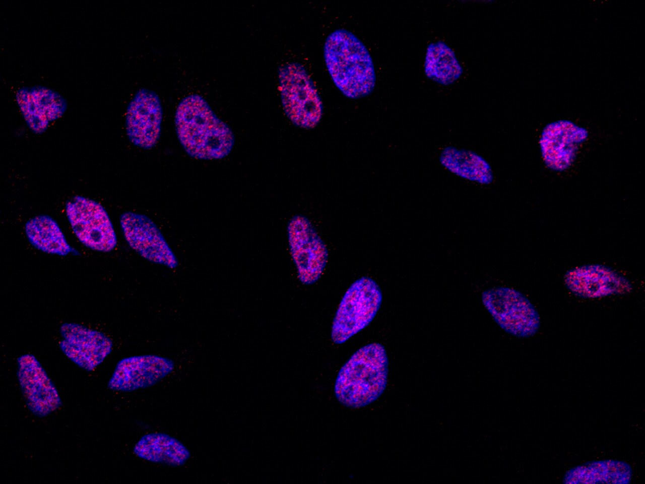 SOX11 Antibody - Azide and BSA Free