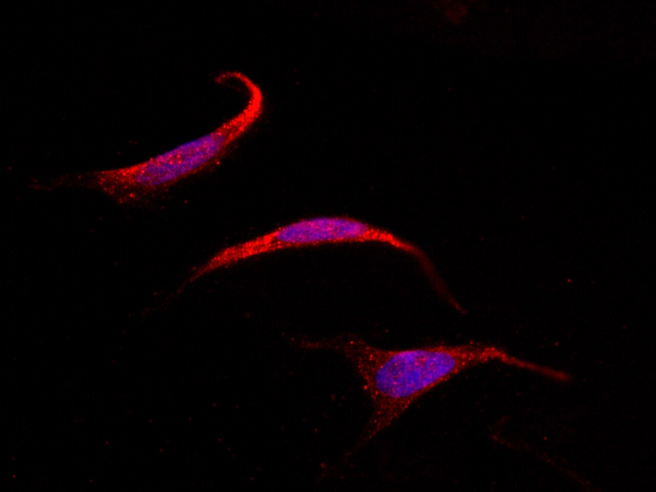 SOCS-4 Antibody - Azide and BSA Free