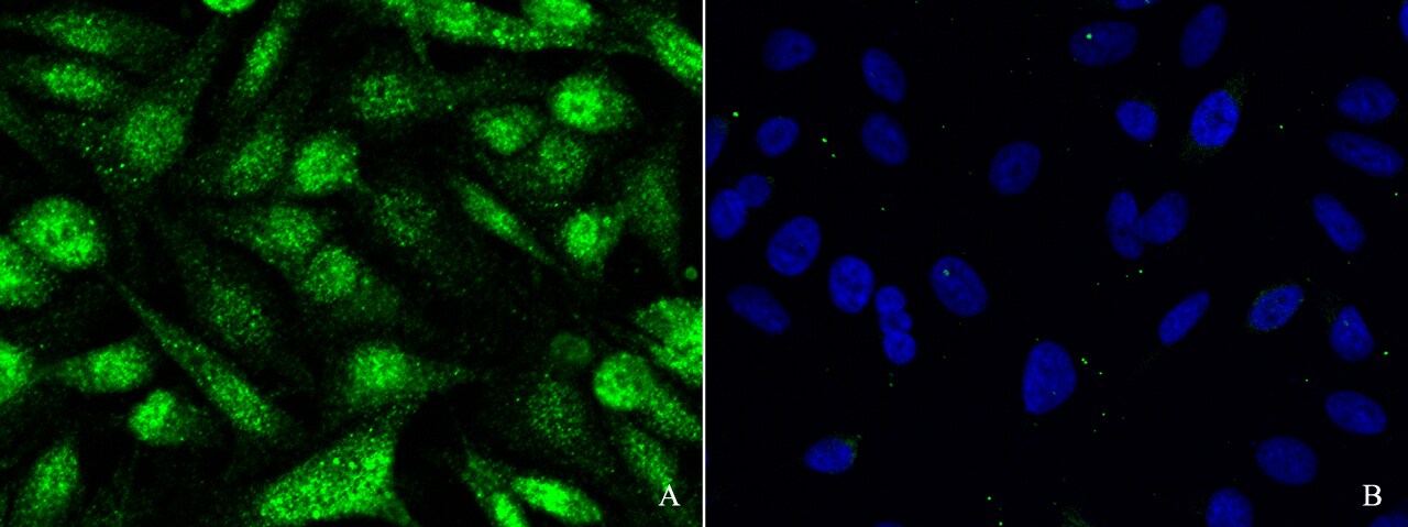 SOCS-1 Antibody - Azide and BSA Free