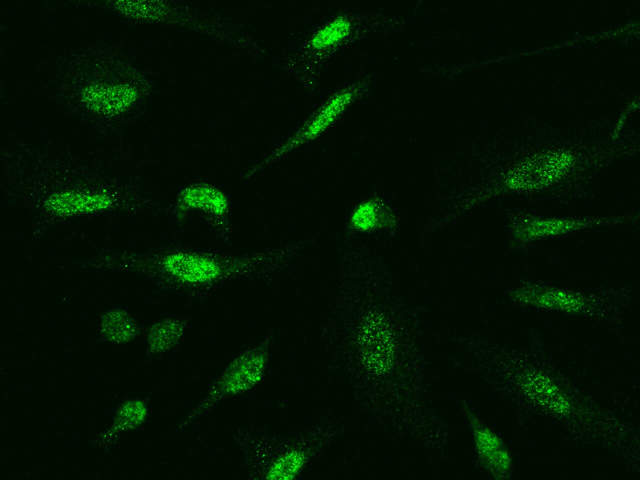 SOCS-1 Antibody - Azide and BSA Free