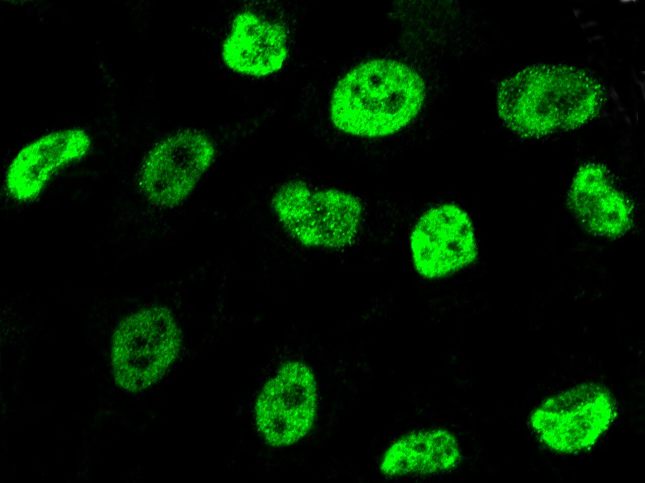RAR beta/NR1B2 Antibody - Azide and BSA Free