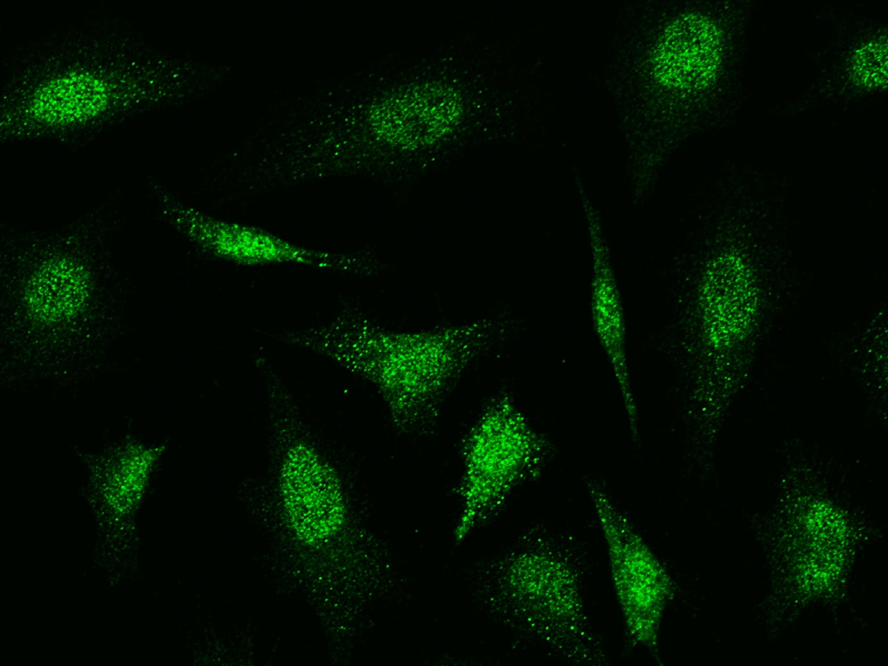 Cofilin 2 Antibody - Azide and BSA Free
