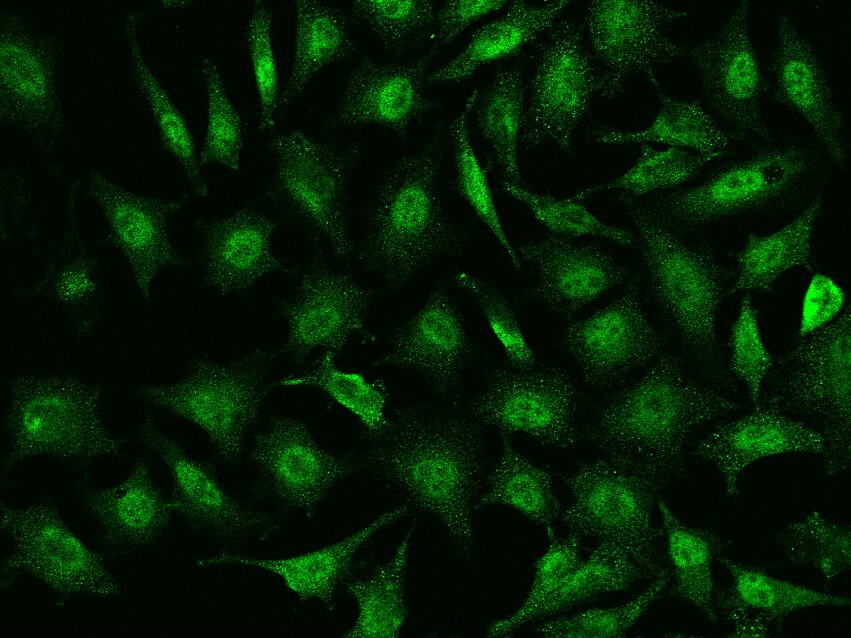TIPIN Antibody - BSA Free