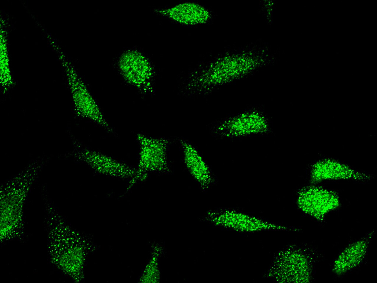 E6AP/UBE3A Antibody - Azide and BSA Free