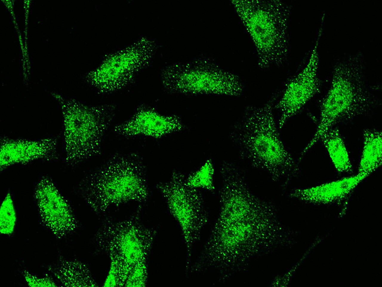 Jade-1/PHF17 Antibody - Azide and BSA Free