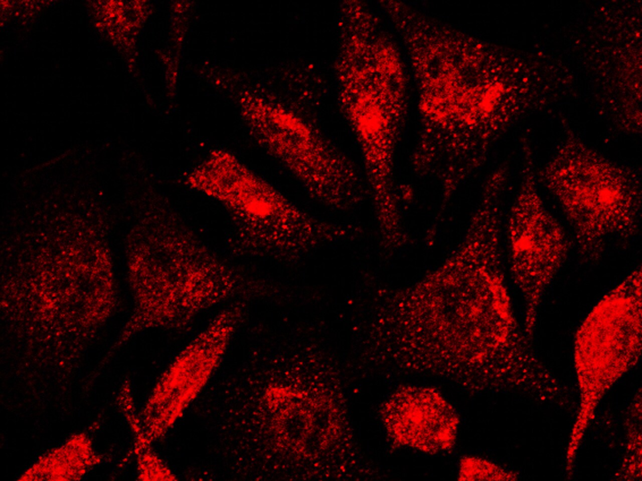 Lysine (K)-specific Demethylase 3A/KDM3A/JMJD1A Antibody - Azide and BSA Free