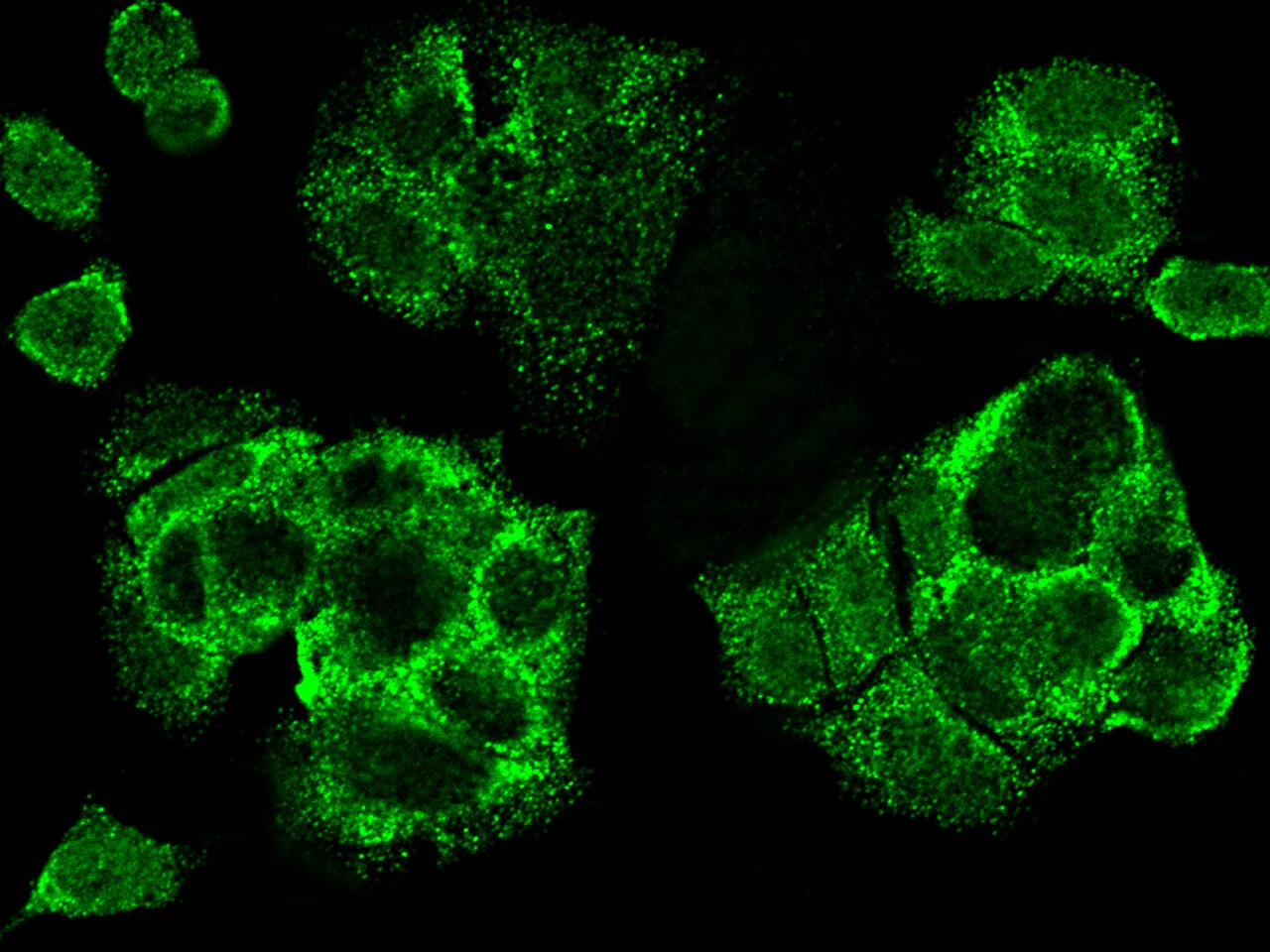 CDCA3 Antibody - Azide and BSA Free