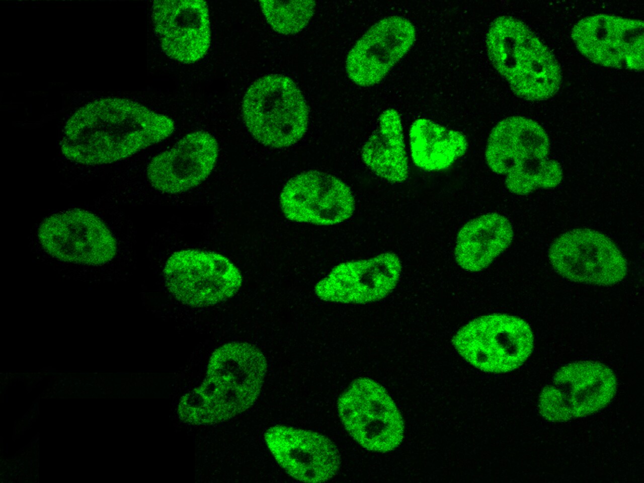 Pax2 Antibody - Azide and BSA Free