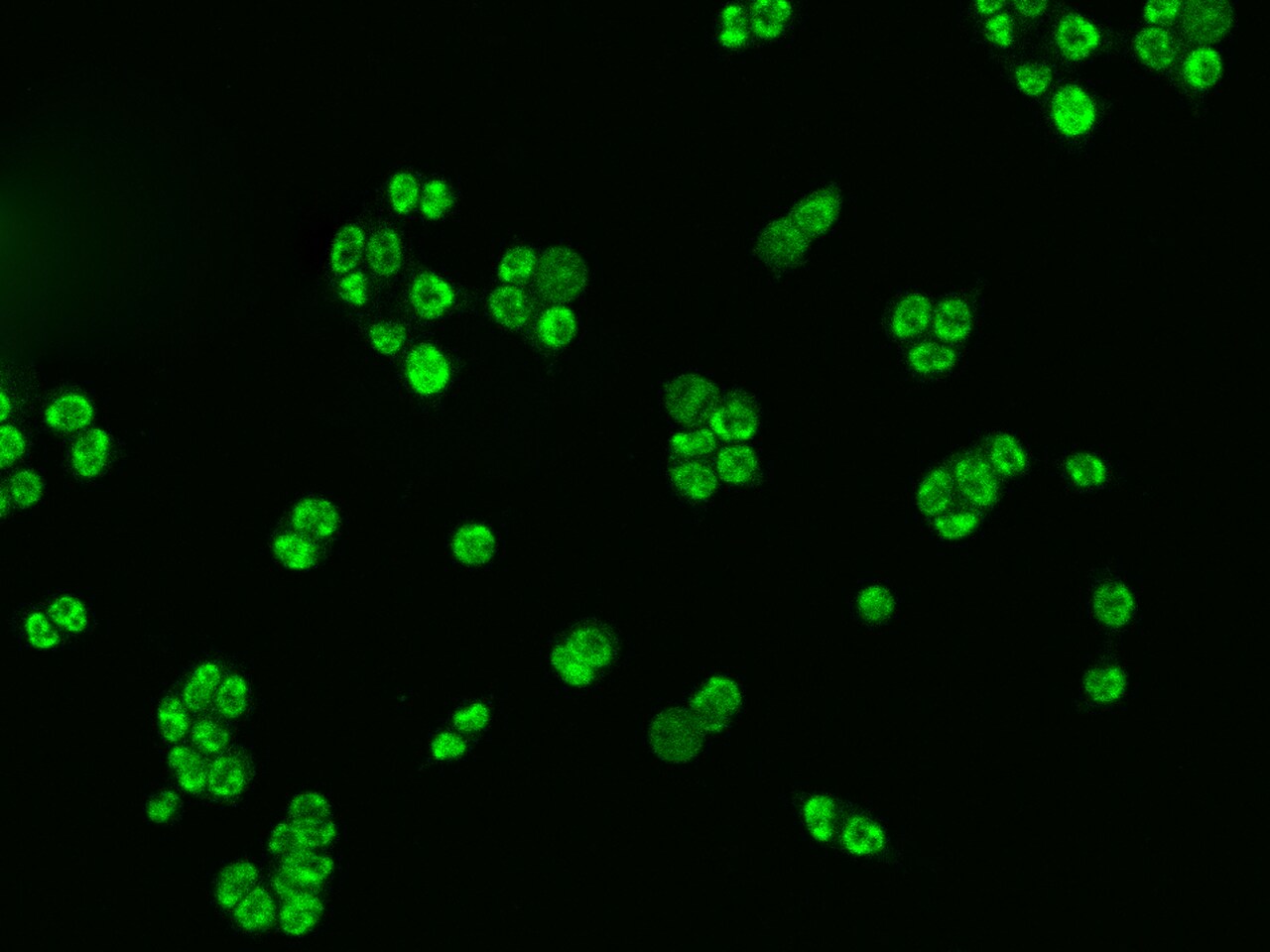 IKK alpha Antibody - Azide and BSA Free