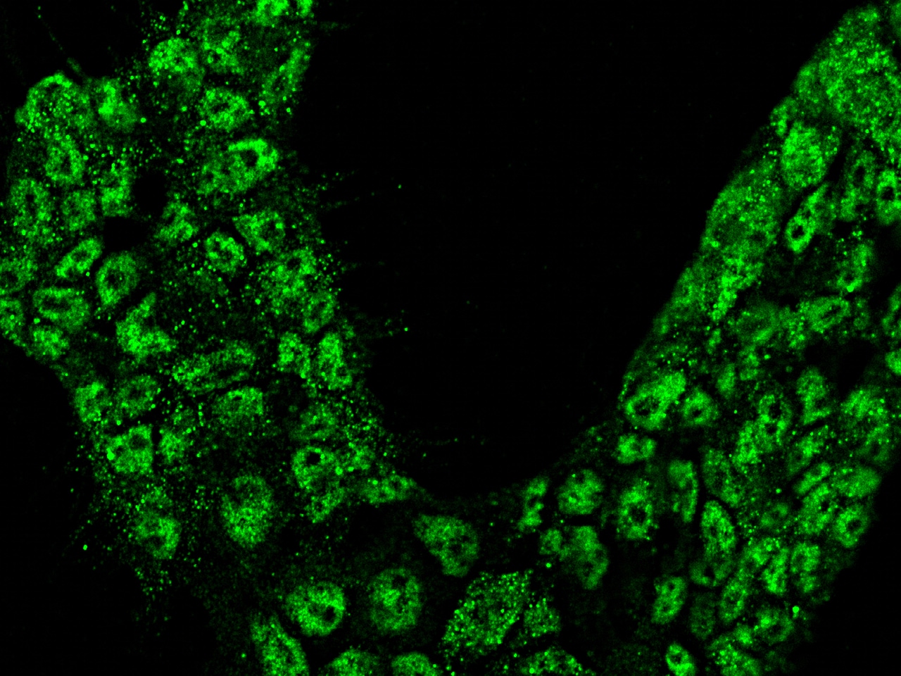 Calbindin D-28K Antibody - Azide and BSA Free