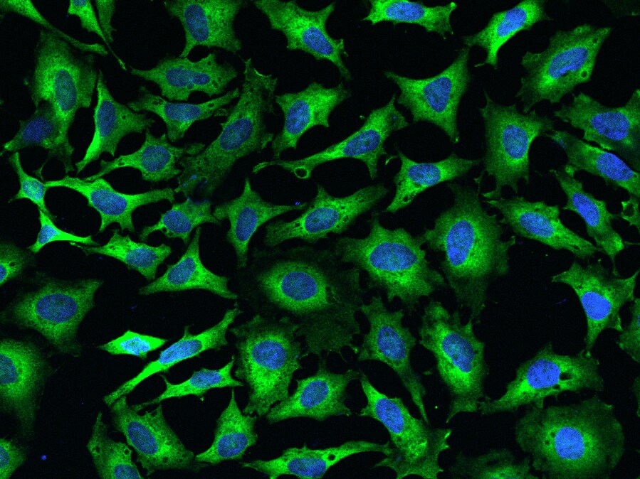 EMAP-II/AIMP1 Antibody - Azide and BSA Free