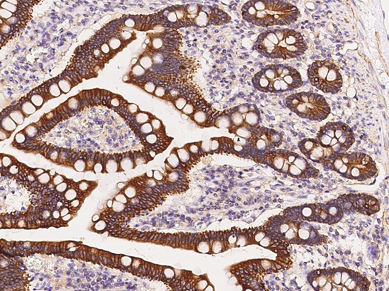 Cytokeratin 12 Antibody - BSA Free