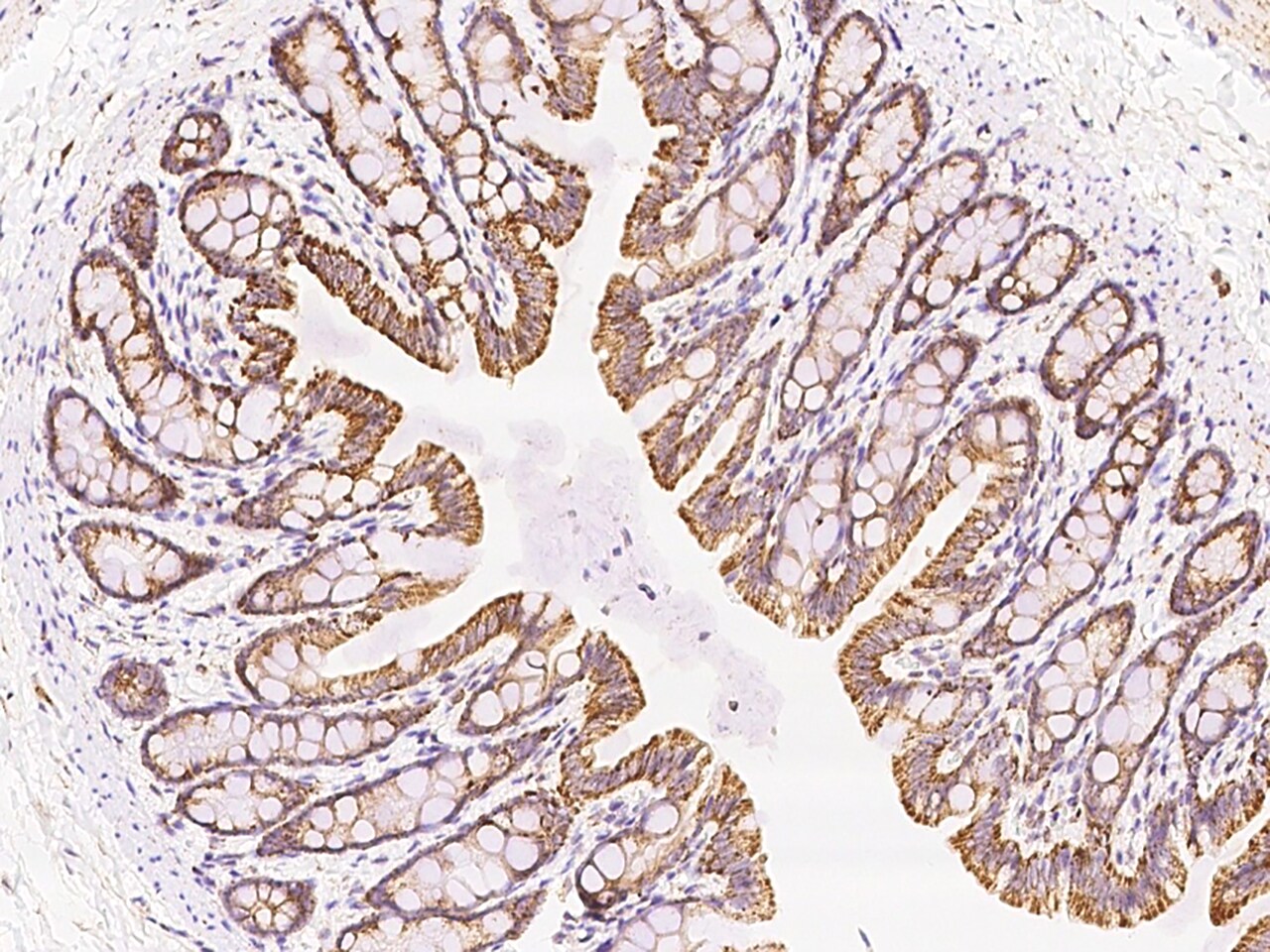 MCTS1 Antibody - Azide and BSA Free
