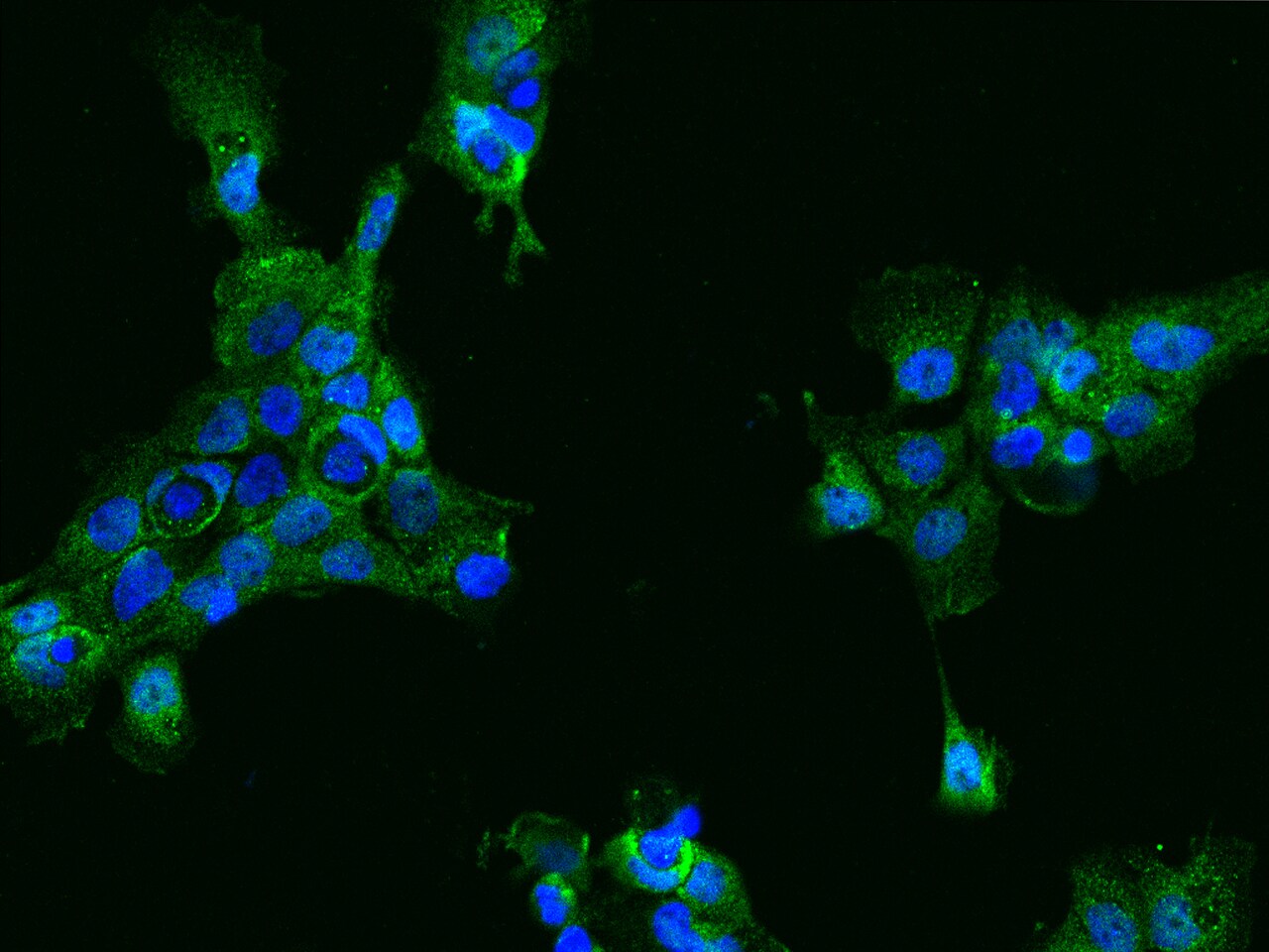ACY3 Antibody - BSA Free