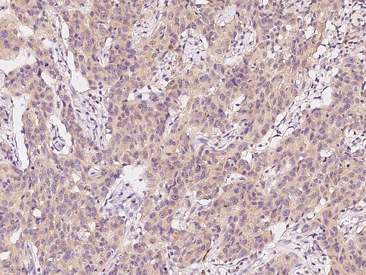 NMT2 Antibody - BSA Free