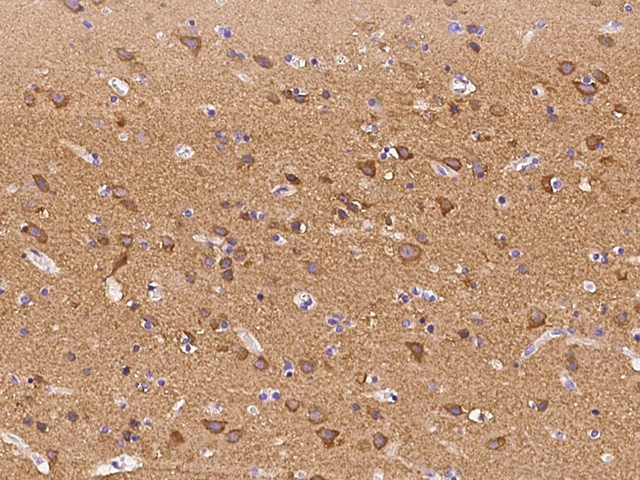 PACSIN1 Antibody - BSA Free