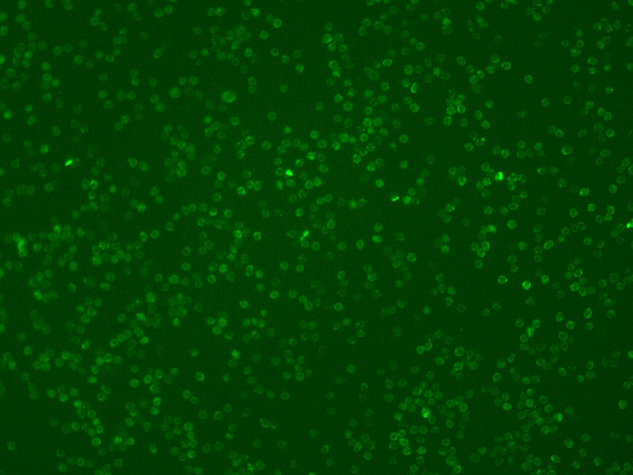 CARD11/CARMA1 Antibody - BSA Free