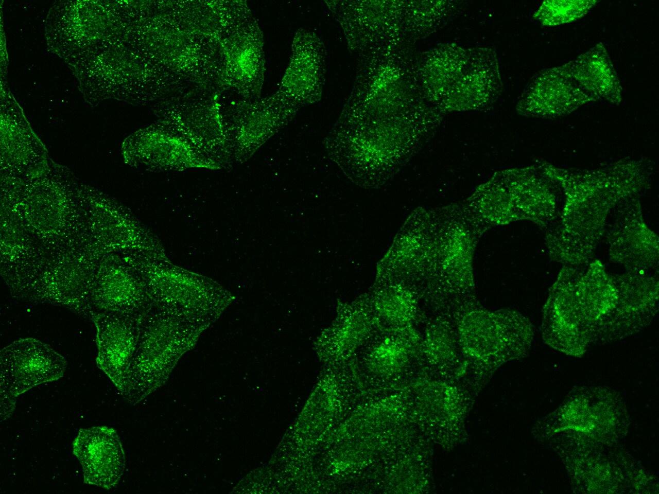 CCT3 Antibody - BSA Free