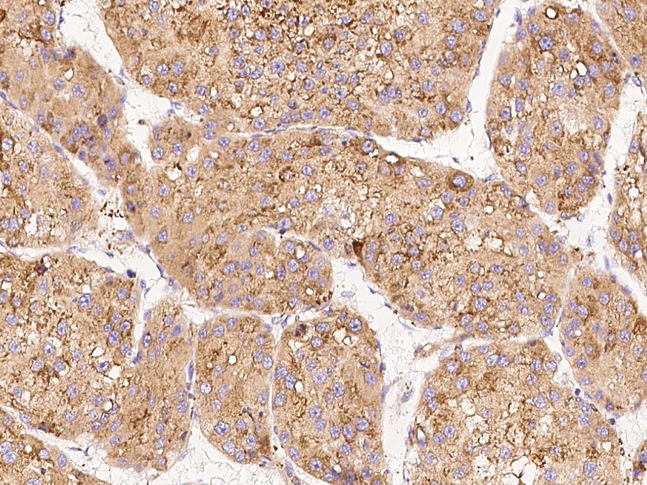 LYK5 Antibody - BSA Free