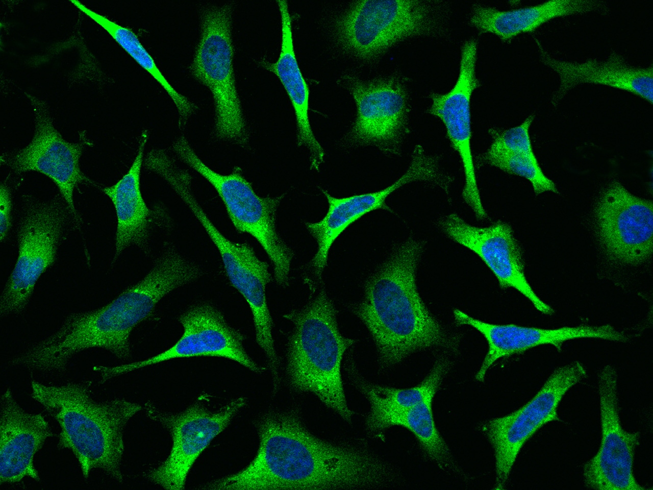 Lysyl tRNA synthetase Antibody - Azide and BSA Free