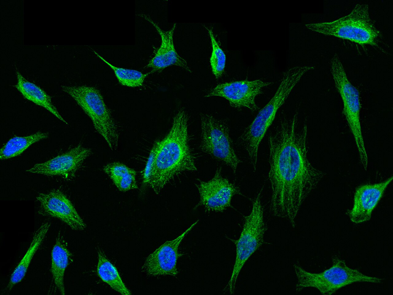Tubulin Beta 4 Antibody - Azide and BSA Free