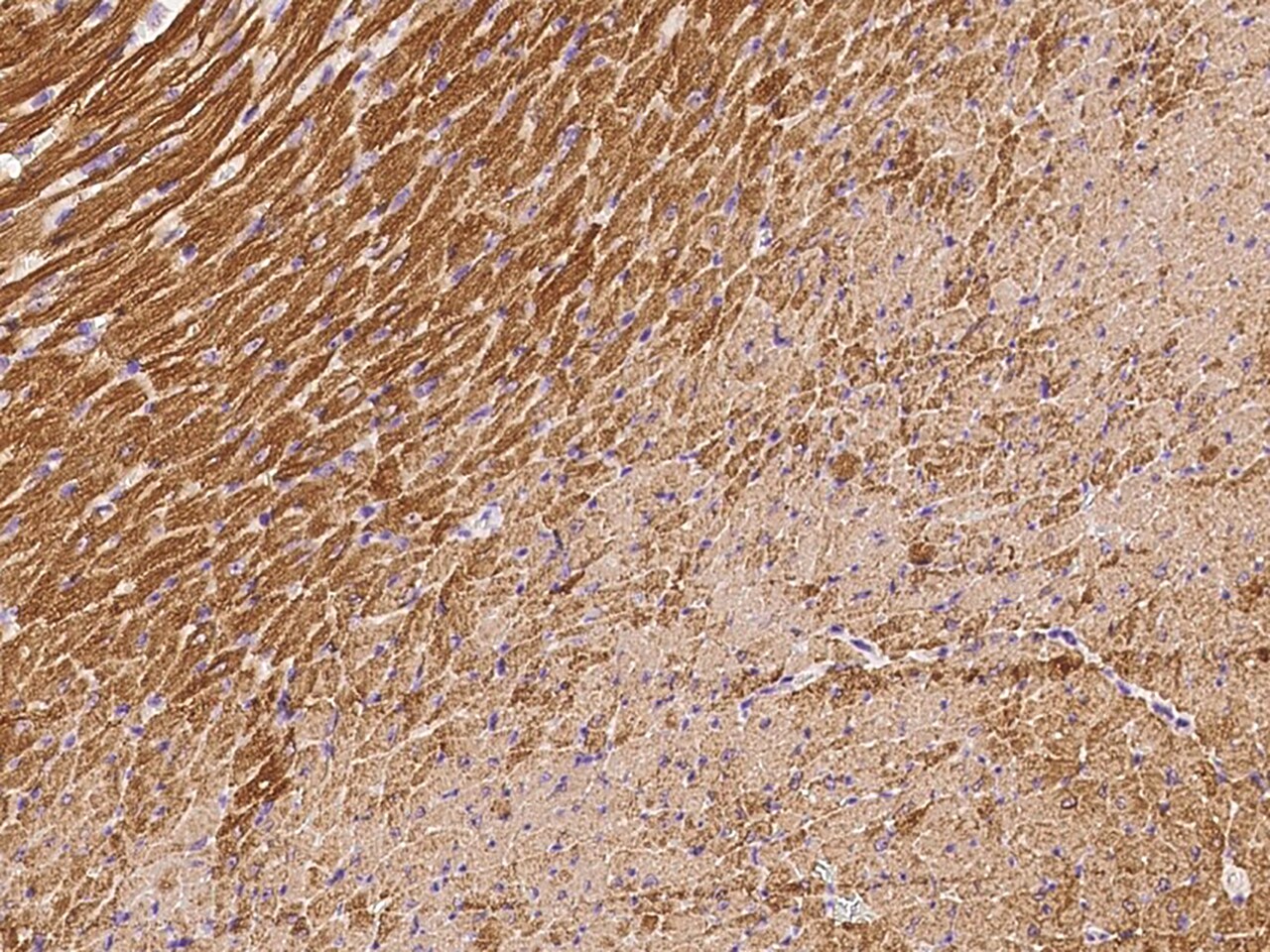 Troponin C (cardiac) Antibody - Azide and BSA Free