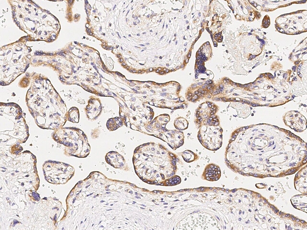 MAPKAP Kinase 3 Antibody - Azide and BSA Free
