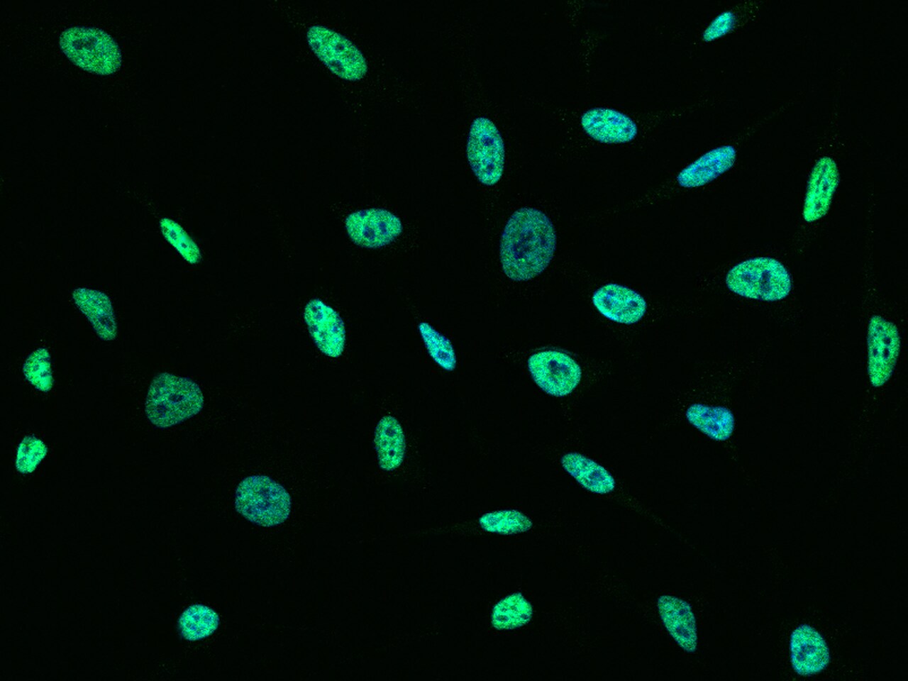 Protein Phosphatase 1C gamma Antibody - Azide and BSA Free