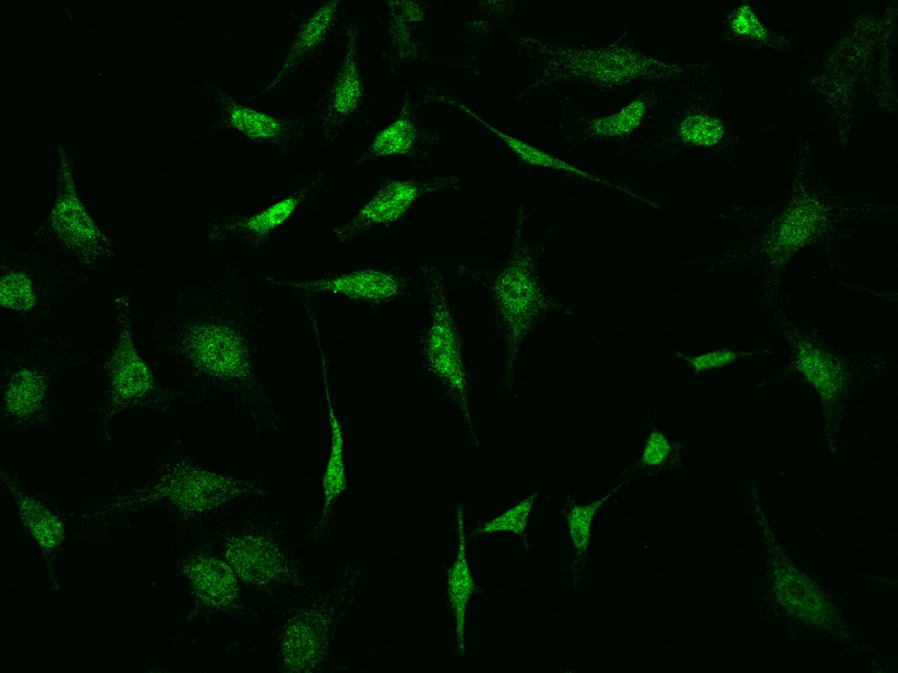 S100P Antibody - Azide and BSA Free