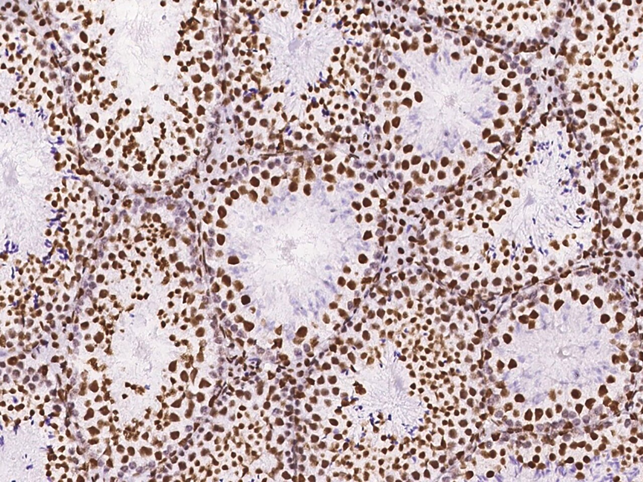 DZIP1 Antibody - BSA Free