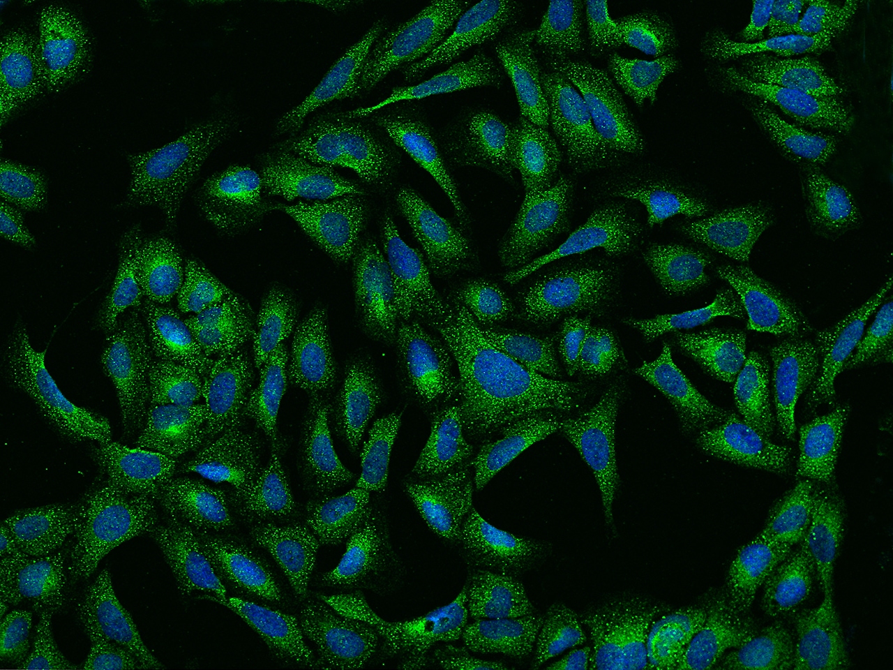 Ribonuclease Inhibitor Antibody - BSA Free