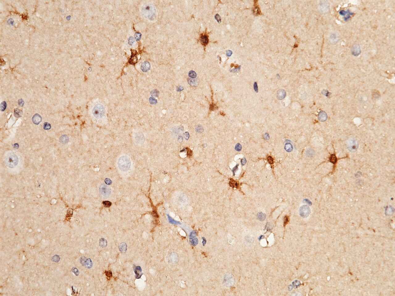 S100A16 Antibody - Azide and BSA Free